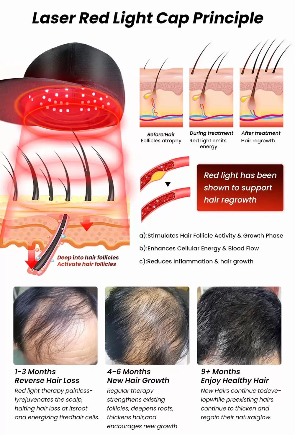 Laser hair growth cap principle