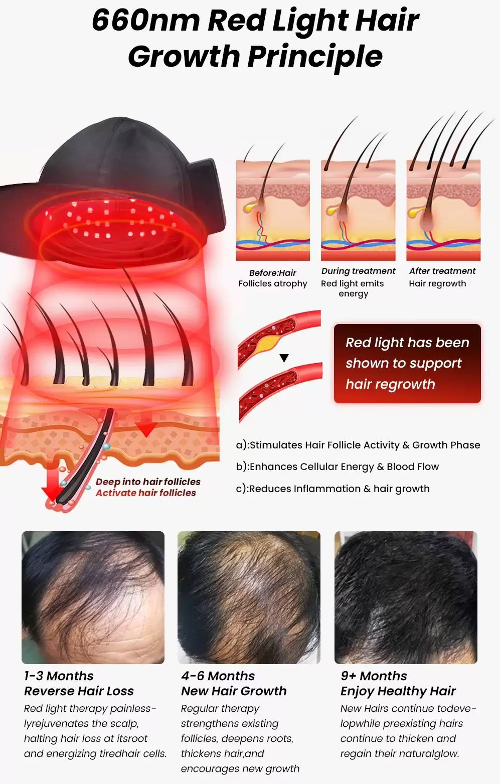 Red light therapy cap principle
